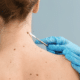 woman having a mole removed from neck